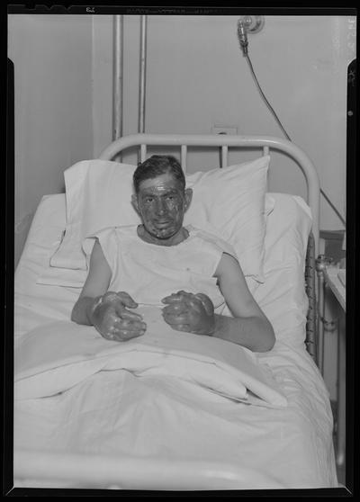 A.E. Oliver; patient; Good Samaritan Hospital, 310-330 South Limestone, burned hands and face