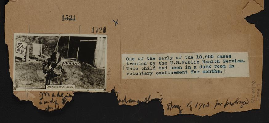 One of the earliest of the 10,000 cases treated by the U.S. Public Health Service. This child had been in a dark room in voluntary confinement for months