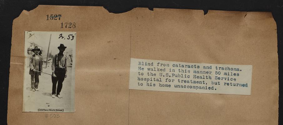 Blind from cataracs and trachoma. He walked in this manner 50 miles to the U.S. Public Health Service hospital for treatment, but returned to his home unaccompanied