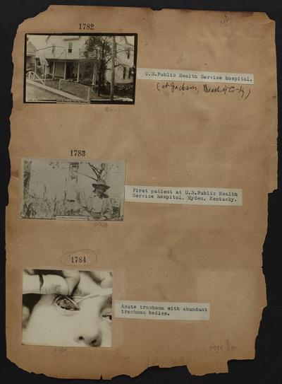 First patient at U.S. Public Health Service hospital; Hyden, Kentucky