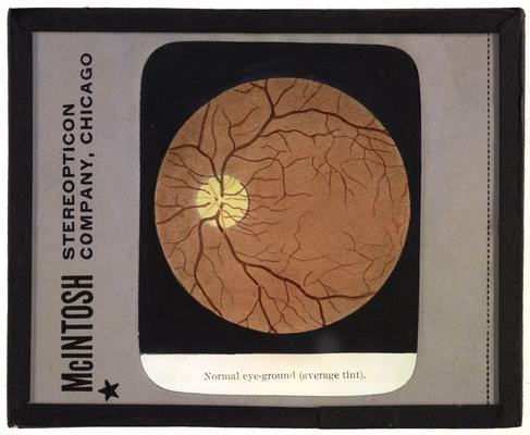 Human eye, Normal eye-ground (average tint), made by McIntosh Stereopticon Company, Chicago