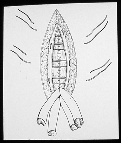 Suturing techniques labeled 