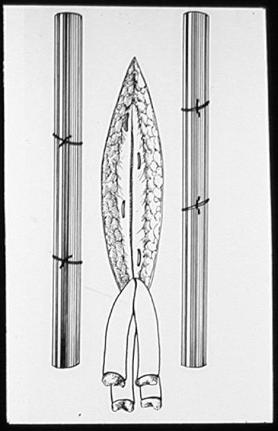 Suturing techniques labeled 