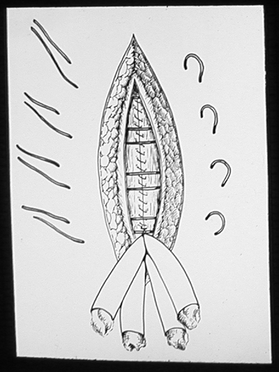 Suturing techniques labeled 