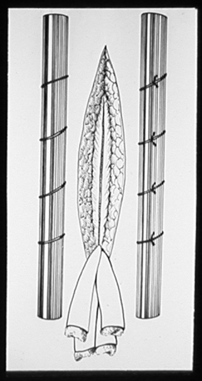 Suturing techniques labeled 