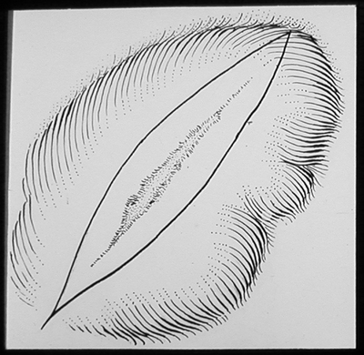 Suturing techniques labeled 