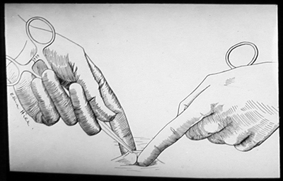 Suturing techniques labeled 